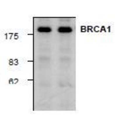 Western Blot: BRCA1 Antibody [NBP1-45410] - Western blot analysis of BRCA1 expression in HeLa (left lane) and NIH3T3 (right lane) cell lysate.