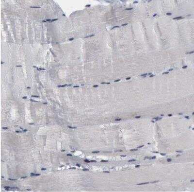 Immunohistochemistry-Paraffin: BRD1 Antibody [NBP1-88351] - Staining of human skeletal muscle shows no positivity in myocytes as expected.