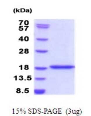 SDS-Page: BRD1 Recombinant Protein [NBP2-51877] - 15% SDS Page (3 ug)