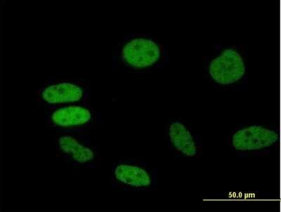 Immunocytochemistry/Immunofluorescence: BRD2 Antibody [H00006046-B01P] - Analysis of purified antibody to BRD2 on HeLa cell. (antibody concentration 10 ug/ml)