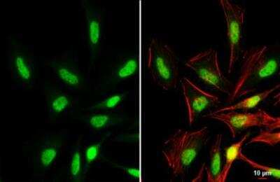 Immunocytochemistry/Immunofluorescence: BRD3 Antibody [NBP2-15612] - BRD3 antibody detects BRD3 protein at nucleus by immunofluorescent analysis. Sample: HeLa cells were fixed in 4% paraformaldehyde at RT for 15 min. Green: BRD3 stained by BRD3 antibody diluted at 1:500. Red: phalloidin, a cytoskeleton marker, diluted at 1:200. Scale bar= 10 um.