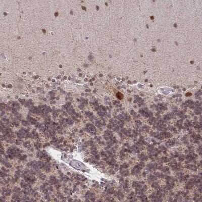 Immunohistochemistry-Paraffin: BRD3 Antibody [NBP2-14360] - Staining of human cerebellum shows strong nuclear positivity in Purkinje cells.