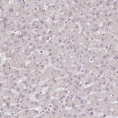 Immunohistochemistry-Paraffin: BRD3 Antibody [NBP2-14360] - Staining of human liver shows no positivity in hepatocytes as expected.