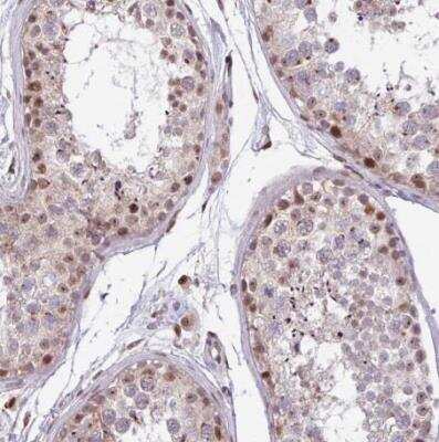 Immunohistochemistry-Paraffin: BRD3 Antibody [NBP2-14360] - Staining of human testis shows moderate nuclear psotivity in cells in seminiferous ducts.