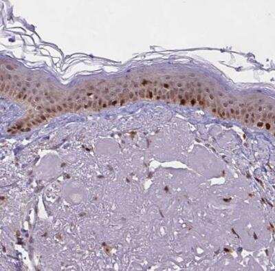 Immunohistochemistry-Paraffin: BRD3 Antibody [NBP2-14360] - Staining of human skin shows moderate to strong nuclear positivity in squamous epithelial cells.