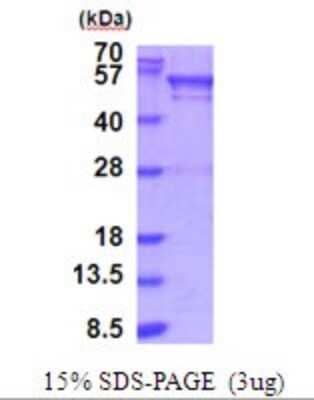 SDS-PAGE Recombinant Human BRD3 His Protein