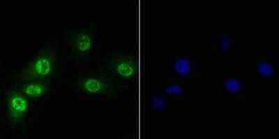 Immunocytochemistry/Immunofluorescence: BRD4 Antibody [NBP2-89108] - Staining of Brd4 in A549 cells (green). Formalin fixed cells were permeabilized with 0.1% Triton X-100 in TBS for 10 minutes at room temperature and blocked with 1% Blocker BSA for 15 minutes at room temperature. Cells were probed with the antibody at a dilution of 1:200 for 1 hour at room temperature, washed with PBS. Alexa Fluor(R)488 Goat anti-Rabbit IgG was used as the secondary antibody at 1/100 dilution. The nuclear counter stain is DAPI (blue).
