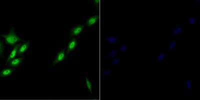 Immunocytochemistry/Immunofluorescence: BRD4 Antibody [NBP2-89108] - Staining of Brd4 in SiHa cells (green). Formalin fixed cells were permeabilized with 0.1% Triton X-100 in TBS for 10 minutes at room temperature and blocked with 1% Blocker BSA for 15 minutes at room temperature. Cells were probed with the antibody at a dilution of 1:200 for 1 hour at room temperature, washed with PBS. Alexa Fluor(R)488 Goat anti-Rabbit IgG was used as the secondary antibody at 1/100 dilution. The nuclear counter stain is DAPI (blue).