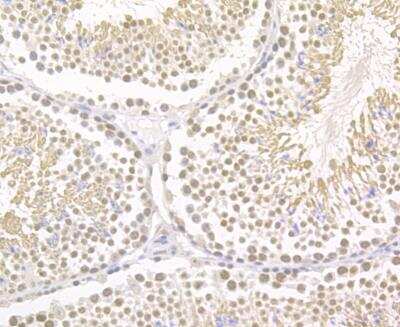 Immunohistochemistry-Paraffin: BRD4 Antibody [NBP2-89108] - Analysis of paraffin-embedded mouse testis tissue using anti-Brd4 antibody. The section was pre-treated using heat mediated antigen retrieval with sodium citrate buffer (pH 6.0) for 20 minutes. The tissues were blocked in 5% BSA for 30 minutes at room temperature, washed with ddH2O and PBS, and then probed with the antibody at 1/200 dilution, for 30 minutes at room temperature and detected using an HRP conjugated compact polymer system. DAB was used as the chromogen. Counter stained with hematoxylin and mounted with DPX.