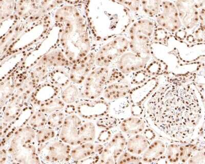 Immunohistochemistry-Paraffin: BRD4 Antibody [NBP2-89108] - Analysis of paraffin-embedded human kidney tissue using anti-BRD4 antibody. The section was pre-treated using heat mediated antigen retrieval with sodium citrate buffer (pH 6.0) for 20 minutes. The tissues were blocked in 1% BSA for 30 minutes at room temperature, washed with ddH2O and PBS, and then probed with the primary antibody (1/600) for 30 minutes at room temperature. The detection was performed using an HRP conjugated compact polymer system. DAB was used as the chromogen. Tissues were counterstained with hematoxylin and mounted with DPX.