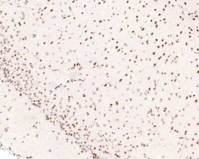 Immunohistochemistry-Paraffin: BRD4 Antibody [NBP2-89108] - Analysis of paraffin-embedded rat brain tissue using anti-Brd4 antibody. The section was pre-treated using heat mediated antigen retrieval with sodium citrate buffer (pH 6.0) for 20 minutes. The tissues were blocked in 1% BSA for 30 minutes at room temperature, washed with ddH2O and PBS, and then probed with the primary antibody (1/600) for 30 minutes at room temperature. The detection was performed using an HRP conjugated compact polymer system. DAB was used as the chromogen. Tissues were counterstained with hematoxylin and mounted with DPX.