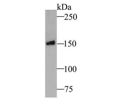 Western Blot: BRD4 Antibody [NBP2-89108] - Analysis of Brd4 on mouse brain tissue lysate. Proteins were transferred to a PVDF membrane and blocked with 5% BSA in PBS for 1 hour at room temperature. The primary antibody was used at a 1:500 dilution in 5% BSA at room temperature for 2 hours. Goat Anti-Rabbit IgG - HRP Secondary Antibody at 1:5,000 dilution was used for 1 hour at room temperature.