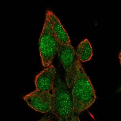 Immunocytochemistry/Immunofluorescence: BRD7 Antibody [NBP2-55751] - Staining of human cell line Hep G2 shows localization to nucleus & cytosol.  Antibody stainng is shown in green.