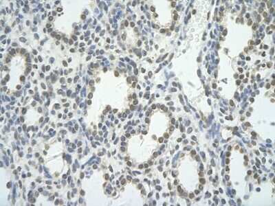 Immunohistochemistry-Paraffin: BRD7 Antibody [NBP2-87080] - Rabbit Anti-BRD7 antibody. Paraffin Embedded Tissue: Human Lung. Cellular Data: alveolar cell. Antibody Concentration: 4.0-8.0 ug/ml. Magnification: 400X
