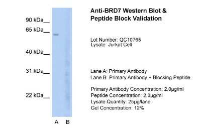Western Blot: BRD7 Antibody [NBP2-87080] - Host: Rabbit. Target Name: BRD7. Sample Type: Jurkat. Lane A: Primary Antibody. Lane B: Primary Antibody + Blocking Peptide. Primary Antibody Concentration: 2.5ug/mL. Peptide Concentration: 2.0ug/mL. Lysate Quantity: 25ug/lane. Gel Concentration: 12%BRD7