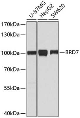<b>Genetic Strategies Validation. </b>Western Blot: BRD7 Antibody [NBP2-92408] - Analysis of extracts of various cell lines, using BRD7 at 1:1000 dilution.Secondary antibody: HRP Goat Anti-Rabbit IgG (H+L) at 1:10000 dilution.Lysates/proteins: 25ug per lane.Blocking buffer: 3% nonfat dry milk in TBST.Detection: ECL Basic Kit .Exposure time: 60s.