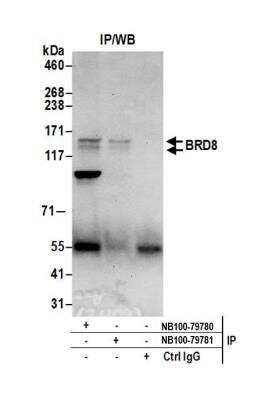 Immunoprecipitation: BRD8 Antibody [NB100-79780] - Detection of human BRD8 by western blot of immunoprecipitates. Samples: Nuclear extract (0.5 or 1.0 mg per IP reaction; 20% of IP loaded) from HeLa cells. Antibodies: Affinity purified rabbit anti-BRD8 antibody NB100-79780 used for IP at 6 ug per reaction. BRD8 was also immunoprecipitated by rabbit anti-BRD8 antibody NB100-79781. For blotting immunoprecipitated BRD8, NB100-79780 was used at 0.4 ug/ml. Detection: Chemiluminescence with an exposure time of 30 seconds.