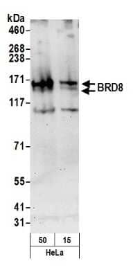 Western Blot: BRD8 Antibody [NB100-79780] - Detection of Human BRD8 by Western Blot. Samples: Nuclear extract (50 and 15 ug) from HeLa cells. Antibody: Affinity purified rabbit anti-BRD8 antibody NB100-79780 used for WB at 0.1 ug/ml. Detection: Chemiluminescence with an exposure time of 30 seconds.