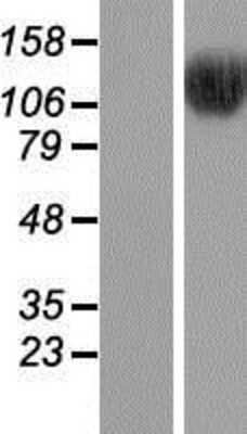 Western Blot: BRD8 Overexpression Lysate (Adult Normal) [NBP2-05580] Left-Empty vector transfected control cell lysate (HEK293 cell lysate); Right -Over-expression Lysate for BRD8.