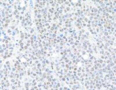 Immunohistochemistry-Paraffin: BRD9 Antibody (BLR153J) [NBP3-14730] -  Section of mouse plasmacytoma. Antibody: Rabbit anti-BRD9 recombinant monoclonal antibody [BLR153J].  Secondary: HRP-conjugatedgoat anti-rabbit IgG. 