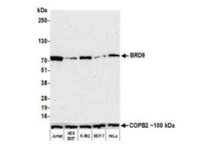 Western Blot: BRD9 Antibody (BLR153J) [NBP3-14730] - Whole cell lysate (30 ug) from Jurkat, HEK293T, K-562, MCF-7, and HeLa cells prepared using NETN lysis buffer. Antibody: Rabbit anti-BRD9 recombinant monoclonal antibody [BLR153J] used at 1:1000. Secondary: HRP-conjugated goat anti-rabbit IgG. Chemiluminescence with an exposure time of 3 minutes. Lower Panel: Rabbit anti-COPB2 antibody. 
