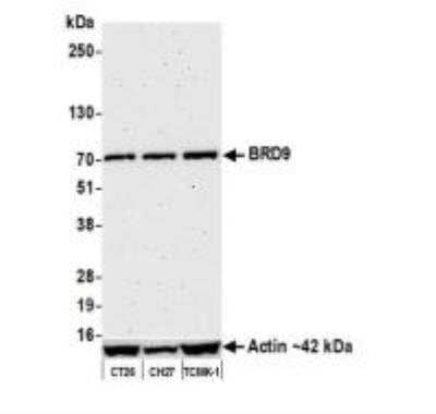 Western Blot: BRD9 Antibody (BLR153J) [NBP3-14730] - Whole cell lysate (30 ug) from CT26, CH27, and TCMK-1 cellsprepared using NETN lysis buffer. Antibody: Rabbit antiBRD9 recombinant monoclonal antibody [BLR153J]  used at 1:1000. Secondary: HRPconjugated goat anti-rabbit IgG. Chemiluminescence with an exposure time of 3 minutes.Lower Panel: Rabbit anti-Actin recombinant monoclonalantibody [BLR057F]. 