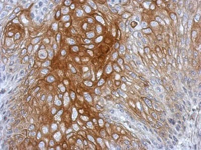 Immunohistochemistry-Paraffin: BRD9 Antibody [NBP2-15614] - Immunohistochemical analysis of paraffin-embedded Cal27 xenograft, using antibody at 1:500 dilution.