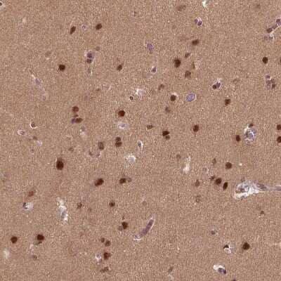 Immunohistochemistry-Paraffin: BRD9 Antibody [NBP2-58517] - Staining of human Cerebral cortex shows strong nuclear positivity in neuronal cells.