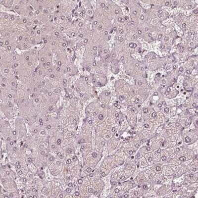 Immunohistochemistry-Paraffin: BRD9 Antibody [NBP2-58517] - Staining of human Liver shows very weak nuclear positivity in hepatocytes.
