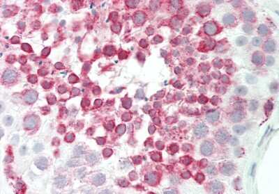 Immunohistochemistry-Paraffin: BRD9 Antibody [NBP2-87083] - Rabbit Anti-BRD9 antibody. Formalin Fixed Paraffin Embedded Tissue: Human Testis. Primary antibody Concentration: 1:100. Secondary Antibody: Donkey anti-Rabbit-Cy3. Secondary Antibody Concentration: 1:200. Magnification: 20x.