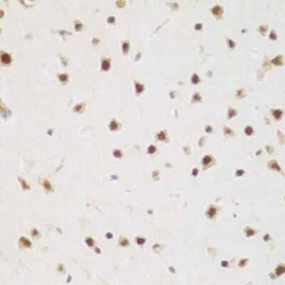 Immunohistochemistry-Paraffin: BRD9 Antibody [NBP3-04971] - Immunohistochemistry of paraffin-embedded mouse brain using BRD9 antibody (NBP3-04971) at dilution of 1:200 (40x lens). Perform microwave antigen retrieval with 10 mM PBS buffer pH 7.2 before commencing with IHC staining protocol.