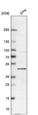 Western Blot: BRD9 Antibody [NBP1-82256] - Analysis in human cell line SiHa.