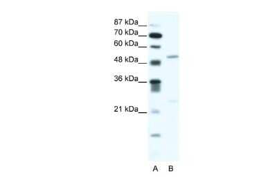 Western Blot: BRD9 Antibody [NBP2-87081] - WB Suggested Anti-BRD9 Antibody Titration: 2.5ug/ml. ELISA Titer: 1:62500. Positive Control: Jurkat cell lysateBRD9 is supported by BioGPS gene expression data to be expressed in Jurkat