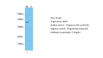 Western Blot: BRD9 Antibody [NBP2-87081] - Host: Rabbit. Target: BRD9. Positive control (+): HeLa Cell Lysate (HL). Negative control (-): Human Kidney (KI). Antibody concentration: 2.5ug/ml