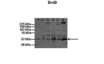 Western Blot: BRD9 Antibody [NBP2-87081] - Lanes: 1: 60ug mouse melanocytes (melba), 2: 60ug mouse melanoma (B16), 3: 60ug human melanocytes (HFSC), 4: 60ug human melanoma (SK-MEL5), 5: 60ug human melanoma (YUMAC), 6: 60ug rat shwann cell. Primary Antibody Dilution: 1:200. Secondary Antibody: Donkey anti-rabbit HPRT. Secondary Antibody Dilution: 1:2000. Gene Name: BRD9. Submitted by: Dr. Ivana de la Serna, University of Toledo. 