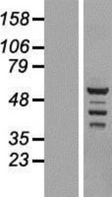 Western Blot: BRD9 Overexpression Lysate (Adult Normal) [NBL1-08025] Left-Empty vector transfected control cell lysate (HEK293 cell lysate); Right -Over-expression Lysate for BRD9.