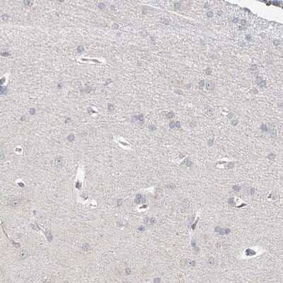 Immunohistochemistry-Paraffin BRDG1/STAP-1 Antibody - BSA Free