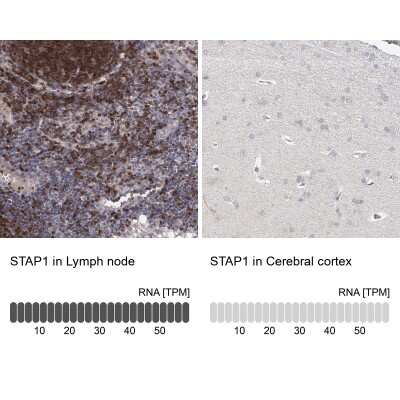 Immunohistochemistry-Paraffin BRDG1/STAP-1 Antibody - BSA Free