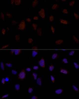 Immunocytochemistry/Immunofluorescence: BRE Antibody [NBP2-92866] - Analysis of U-2 OS cells using BRE . Blue: DAPI for nuclear staining.