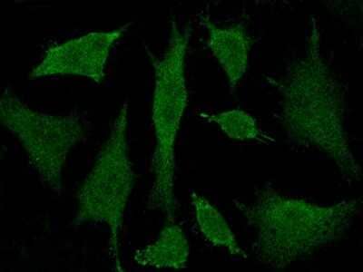 Immunocytochemistry/Immunofluorescence: BRE Antibody [NBP2-99253] - Immunofluorescence staining of BRE in Hela cells. Cells were fixed with 4% PFA, permeabilzed with 0.3% Triton X-100 in PBS, blocked with 10% serum, and incubated with rabbit anti-Human BRE polyclonal antibody (dilution ratio 1:500) at 4C overnight. Then cells were stained with the Alexa Fluor$488-conjugated Goat Anti-rabbit IgG Secondary antibody (green). Positive staining was localized to cytoplasm and nucleus.