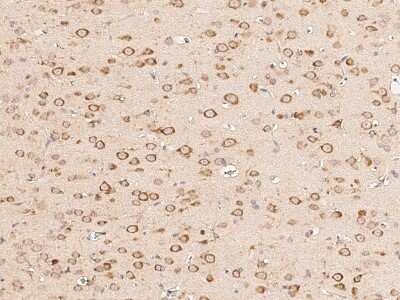 Immunohistochemistry-Paraffin: BRE Antibody [NBP2-99253] - Immunochemical staining BRE in rat brain with rabbit polyclonal antibody (1:1000, formalin-fixed paraffin embedded sections).