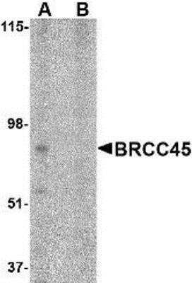 Western Blot: BRE Antibody [NBP1-76830] - HeLa cell lysate in (A) the absence and (B) presence of blocking peptide with BRE antibody at 1 ug/ml.