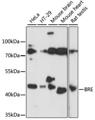 Western Blot: BRE Antibody [NBP2-92866] - Analysis of extracts of various cell lines, using BRE at 1:1000 dilution.Secondary antibody: HRP Goat Anti-Rabbit IgG (H+L) at 1:10000 dilution.Lysates/proteins: 25ug per lane.Blocking buffer: 3% nonfat dry milk in TBST.Detection: ECL Basic Kit .Exposure time: 60s.