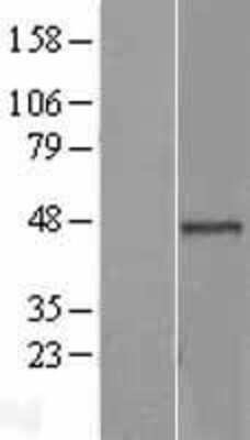 Western Blot: BRE Overexpression Lysate (Adult Normal) [NBL1-08026] Left-Empty vector transfected control cell lysate (HEK293 cell lysate); Right -Over-expression Lysate for BRE.