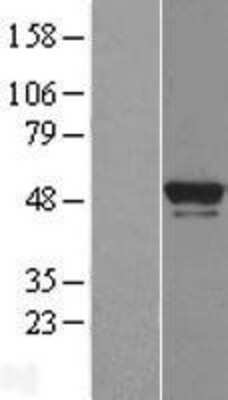 Western Blot: BRF2 Overexpression Lysate (Adult Normal) [NBL1-08027] Left-Empty vector transfected control cell lysate (HEK293 cell lysate); Right -Over-expression Lysate for BRF2.