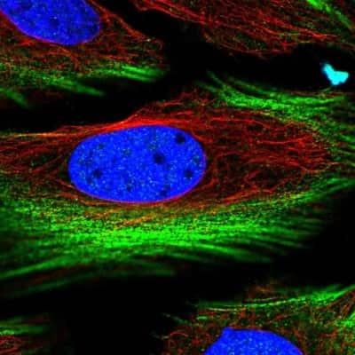 Immunocytochemistry/ Immunofluorescence BRICD5 Antibody - BSA Free