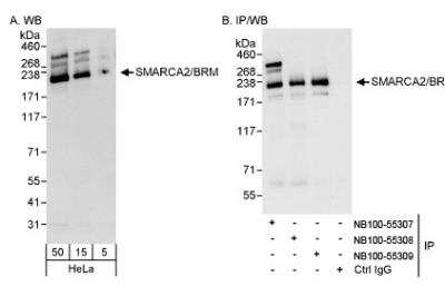 Western Blot: BRM Antibody [NB100-55307] - Detection of Human SMARCA2/BRM on HeLa whole cell lysate. SMARCA2/BRM was also IPed by rabbit anti-SMARCA2/BRM antibodies NB100-55308 and NB100-55309.