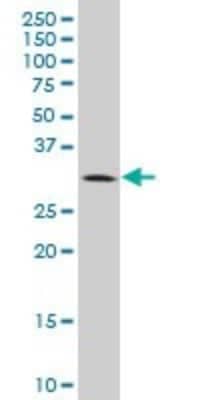 Western Blot BRMS1 Antibody (2D4-2G11)