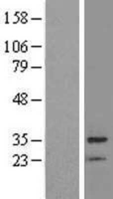 Western Blot BRMS1 Overexpression Lysate