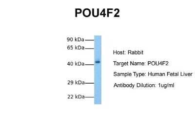 Western Blot: BRN3B/POU4F2 Antibody [NBP2-86585] - Host: Rabbit. Target Name: POU4F2. Sample Tissue: Human Fetal Liver. Antibody Dilution: 1.0ug/ml